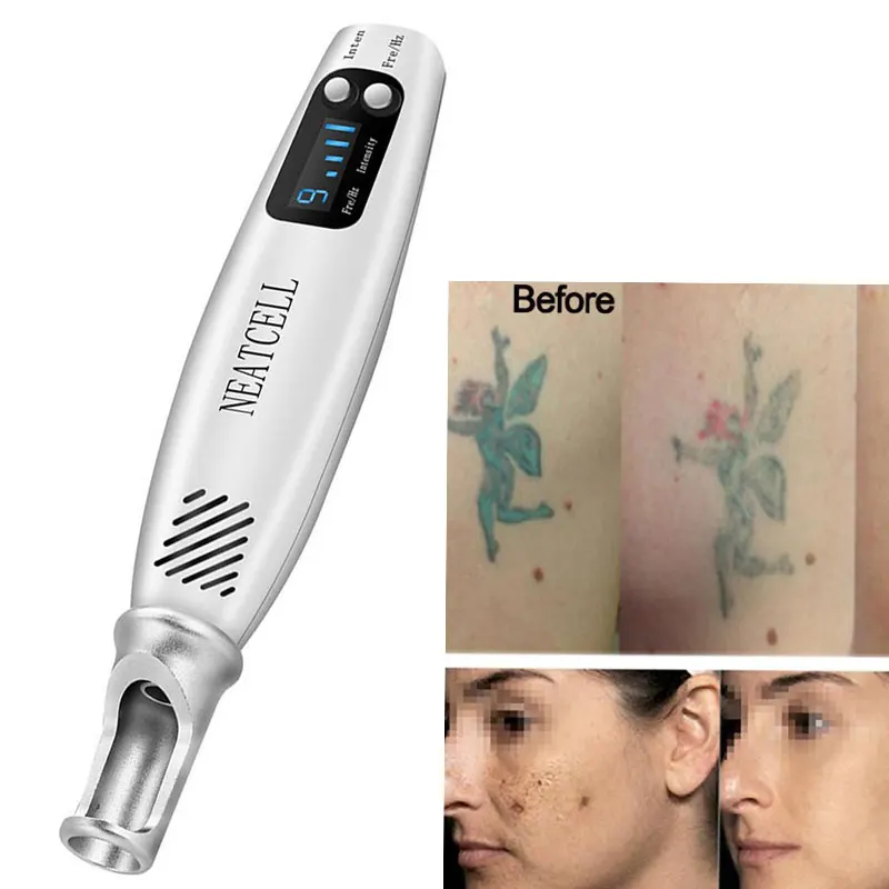 Mini handheld picosecunde Laser Pen Pentru tatuaj pete de melanina de Ștergere Aluniță Dispozitiv Instrument 2